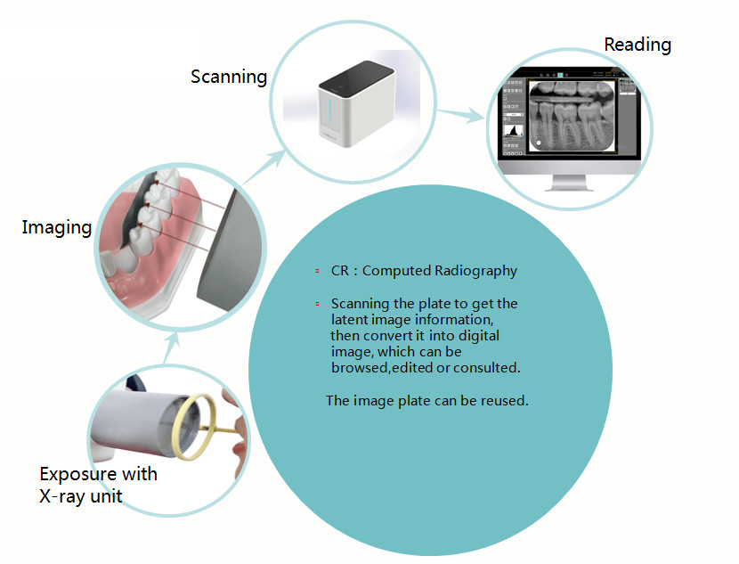 CR Imaging Plate Intraoral Dental X Ray Film Scanner