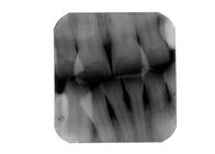 BLX-5 Panoramic Tripod Optional Portable Digitizer Dental X-ray Unit
