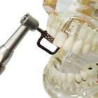 Dental Orthodontic Interproximal Enamel Reduction IPR Contra Angle Kit