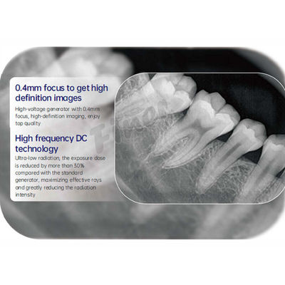 Advanced Intraoral Dental Digital X Ray Machine With High-Resolution Sensor